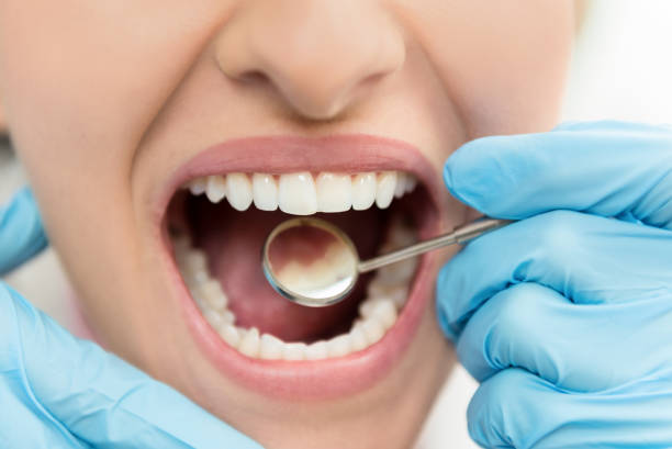 Dental Implants Surgery Houston Texas 